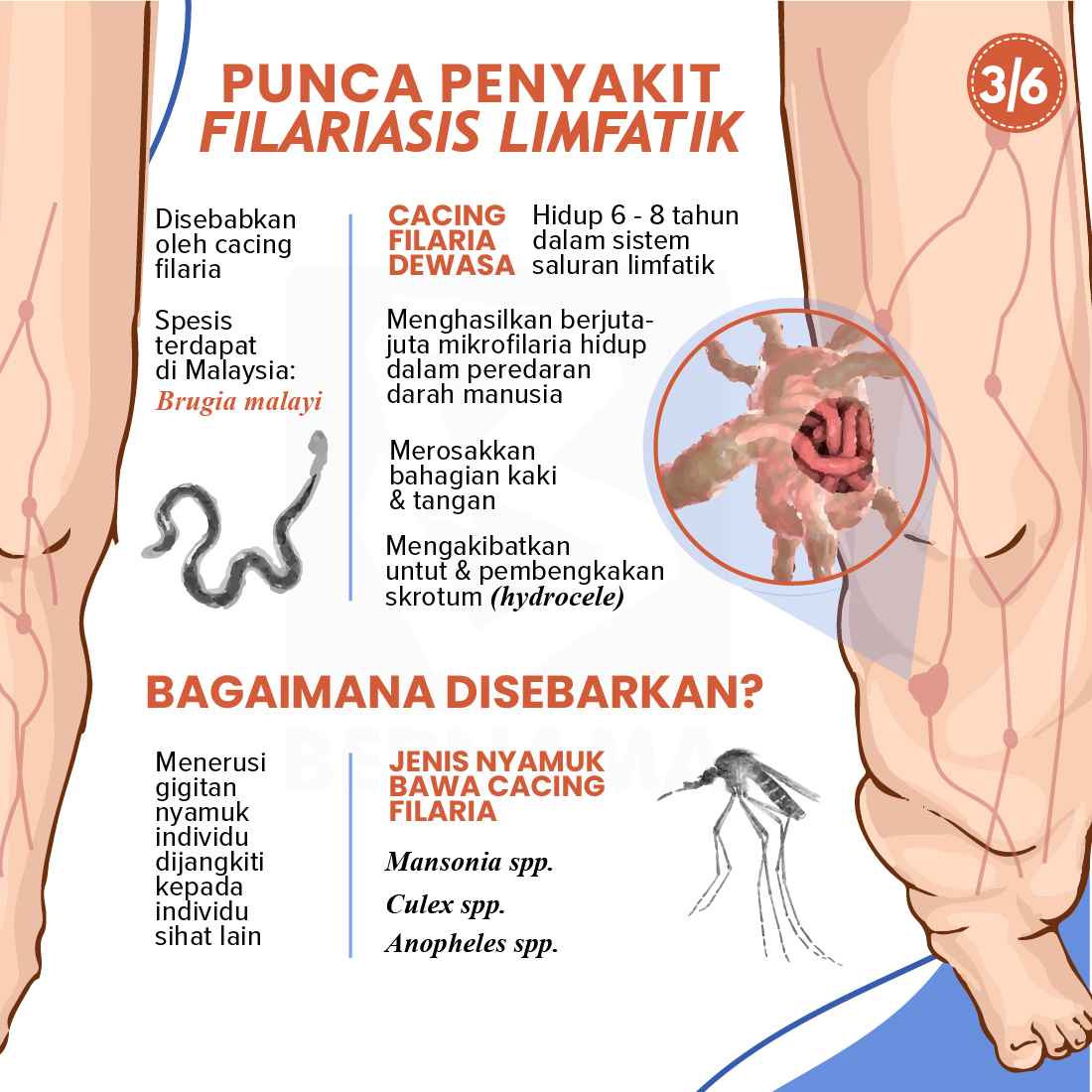 Filariasis Limfatik